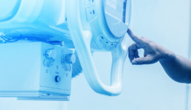 X-ray machine examining internal components, representing advanced healthcare technology and diagnostics.
